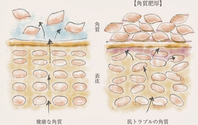 説明図